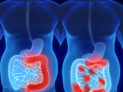 Crohns and Colitis 600x600