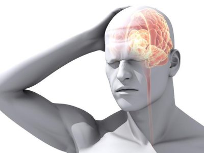 migraine