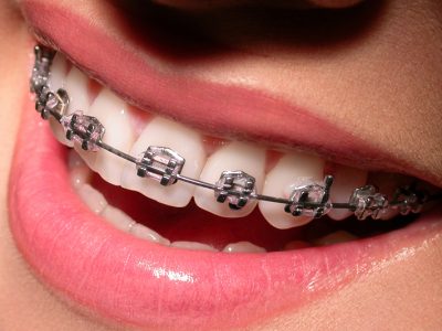 orthodontics